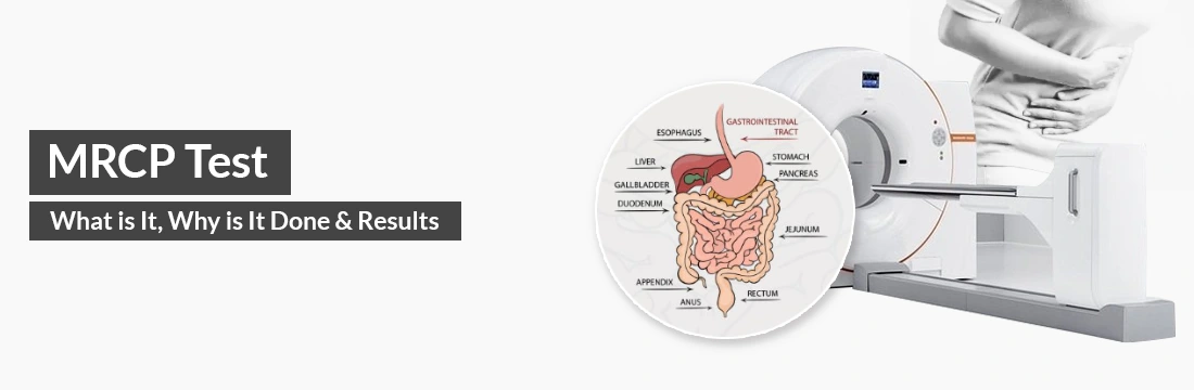 MRCP Test: What is It, Why is It Done, Results